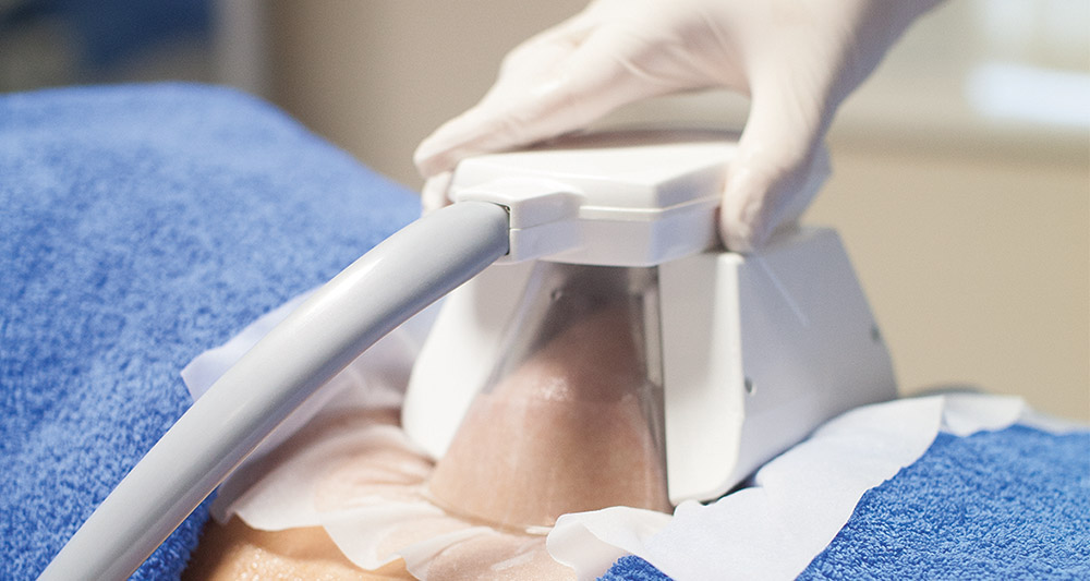 How Fat Freezing and HIFU Work Together? 2 Multiple Areas in One Session HIFU and Fat Freezing Leicestershire