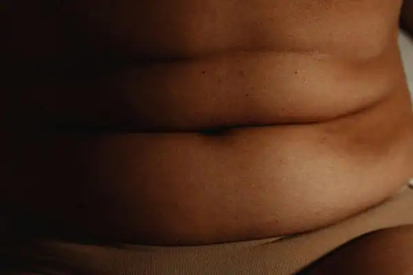 The Hidden Connection: How Stress Shapes Your Fitness and Body Composition 3 image of what stress can do on the stomach area and how Lipo 360 Leicestershire can help to change your body shape.